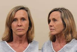 Sister-in-law of crime kingpin Terry Adams facing jail for 'trying to  smuggle phone into prison'