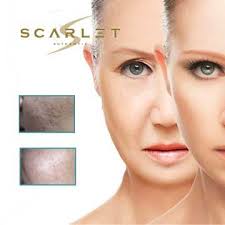 Antiaging Teknolojisi Scarlet S Ameliyatsiz Cilt Genclestirme Leke Tedavisi Ve Kirisiklik Tedavileri Cilt Bakimi Selulit Kolajen