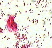 Image result for Acid Fast Stain