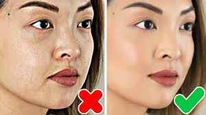 When i first started using it, i would see real results after just 6 hours of wearing it. How To Get Rid Of Hyperpigmentation Dark Spots Fast Youtube