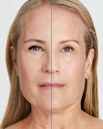 Renew Skin Clinic added a new photo —...