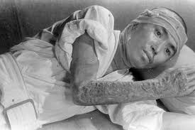 The chernobyl disaster was so big, parts of europe and scandinavia also felt some minimal effects of the event. The Photographers Who Captured The Toll Of Hiroshima And Nagasaki The New York Times