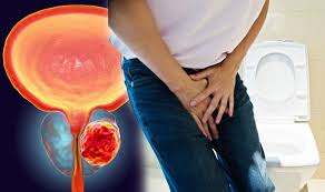 Being armed with information is vital to begin the fight. Prostate Cancer Symptoms A Weak Flow When Urinating Could Be A Warning Sign Express Co Uk