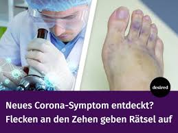 Das überraschte auch eine spanische ärztegemeinschaft namens teledermasolidaria, die im home office patienten online betreut und per email vermehrt fotos von. Desired Gleich Mehrere Internationale Mediziner Berichten Bereits Uber Die Covid Zehen Sl Desired De Corona Covid Zehen Facebook