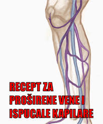 In cazul in care acestea apar, pot include: Venska Tromboza Se Mozete Spreciti Na Ove Nacine Minut Za Mene