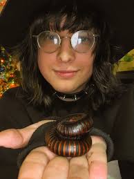 What causes fine facial features and disproportionate limbs?