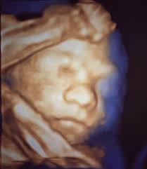 Dott.ssa Daniela Costa, ginecologa