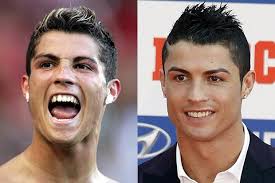 Are you ready to experience the amazing changes that people watch? Cristiano Ronaldo Dentist