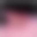 Image result for Glomus tumor