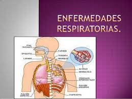 ¿qué es (enfermedades respiratorias) y en qué consiste? Enfermedades Respiratorias