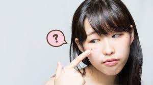 Anda dapat mencoba beberapa cara membuat tahi lalat alami seperti yang berikut ini Bagaimana Cara Menghilangkan Tahi Lalat Orami