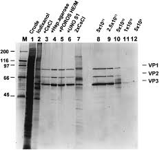 Image result for Black 1997 AAV