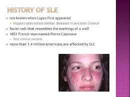 Staci Smith DO Nephrology Grandview Hospital