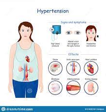 Liquid Hypertension Medication