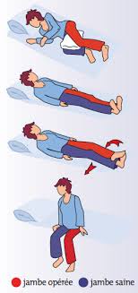 Proth se totale de hanche dr m adasy coxarthrose suite d'une usure m canique d'une hanche o. Conseils Pratiques Apres La Mise En Place D Une Prothese De Hanche Ou De Genou Vie Quotidienne Gymnastique Activites De Loisirs Prothese Articulaire En 100 Questions