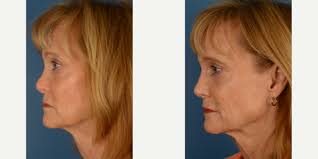 Aesthetic Surgery Center