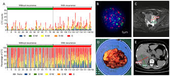 Your medical team can use chemotherapy and other treatments to slow cancer growth and control symptoms, but recurrent ovarian cancer is rarely curable. Development And Validation For Prognostic Nomogram Of Epithelial Ovarian Cancer Recurrence Based On Circulating Tumor Cells And Epithelial Mesenchymal Transition Scientific Reports