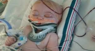 Yataktan Dusen Bebek Bu Hale Geldi Anne Simdi Tum Ebeveynleri Uyariyor