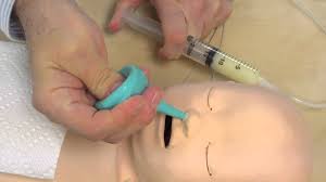 If the prongs are curved, they should point downward inside the nostrils. Building A Nasal Secretions Simulator Jump Simulation