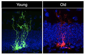 Usc Stem Cell Study Reveals Neural Stem Cells Age Rapidly Eurekalert Science News