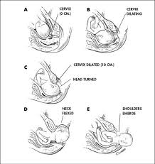 Can you walk around with 4 cm dilation? Pin On Pregnancy And Labor