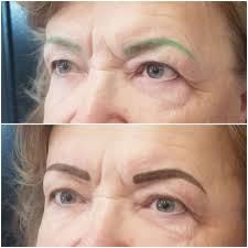 Wanda Enoch Cosmetic Enhancements