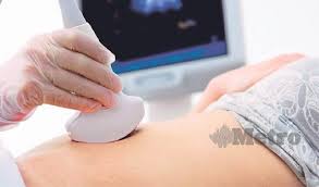 Hamil selepas amal jamu zuriat. Nak Hamil Lagi Tapi Gagal