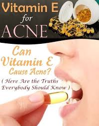 Research health effects, dosing, sources, deficiency symptoms, side effects, and interactions here. Vitamin E Nutrition Sources Benefits Dosage Side Effects Vitamin E For Acne Vitamin E Vitamins
