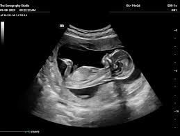 Image result for Ultrasound