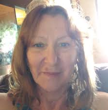 I'm posting about a friend of mine in hopes that someone might have  experience with spider bites and skin grafts. He's been dealing with this  for 3 months 😕 Case : man,