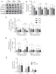 Time‐dependent changes in autophagy, mitophagy and lysosomes in skeletal  muscle during denervation‐induced disuse