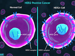 What is 2 colors good colors together? Her2 Positive And Negative Breast Cancers Aggressiveness Treatment And Survival