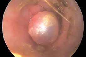 Chronic Otitis A Dermatologist S Perspective On Surgery Today S Veterinary Practice