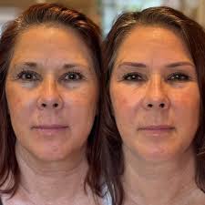 This is what lives rent free in my head 💓 I always have so many pretty  things that don't make it to my feed 🥲 but I'm so thankful for you all