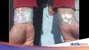 Berikut doa sakit gigi yang diajarkan rasulullah saw: Viral Bawang Putih Ditempel Di Tangan Obati Sakit Gigi Ini Kata Dokter