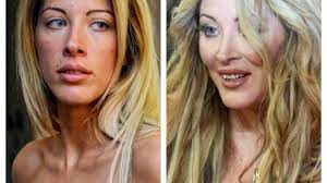 Une spirale infernale qui la détruit à petits feux. Sylvie Ortega The Psychiatric Hospital Her Projects Loana 20 Years After Loft Story Today24 News English