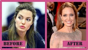 Last week was quite a busy week in the public relations office of asps. Angelina Jolie Plastic Surgery Is Very Popular Among Her Fans