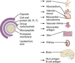 Image result for Poststreptococcal Reactive Arthritis