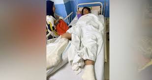 Hewan migrasi terpengaruh pada tingkat ini dan lebih tinggi; Hun Haqeem Cedera Kemalangan Motosikal Nokomen Com