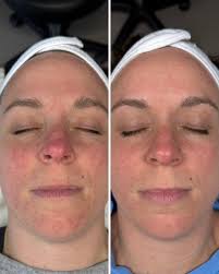 Savanah Summer Beauty