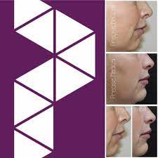 The precise medical aesthetics app makes booking your appointments and managing your loyalty points even easier. Precise Medical Aesthetics Would You Like Me To Improve The Shape Of Your Chin Aesthetic Aestheticclinic Dermalfillers Stirlingaesthetics Stirling Chinfiller Nonsurgicalnosejob Botox Precisemedicalaesthetics Precisemedical Patriciamanson
