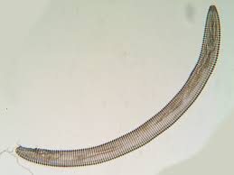 Image result for Colletoecema tortistilum