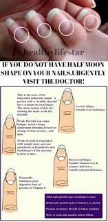 Pin By Arasu Tamil On Health And Welfare Fingernail Health Nail Health Healthy Thyroid