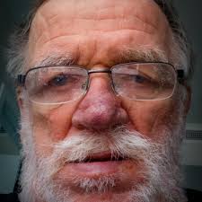 Gary Brosius (@GaryBrosius)