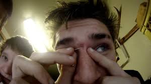 Some eye area piercings are more dangerous than others, and complications can extend to the eye itself and possibly affect vision. Bryces Nipple And Between Eyes Piercing Youtube