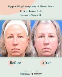 Wake Forest Baptist Facial Plastic & Reconstructive Surgery
