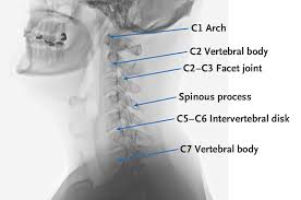 Image result for Neck Exam