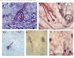 Monascus is a genus of mold. Characterization Of Monascus Purpureus Isolated From Red Yeast Rice And Its Evaluation For The Production Of Cholesterol Lowering Lovastatin Semantic Scholar