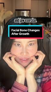 Bone Setting Alignment