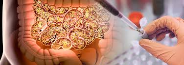 Image result for Fecal Transfer